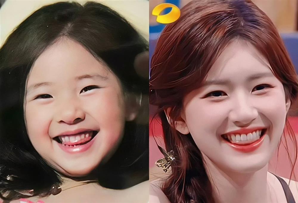 Ảnh ngày bé hé lộ nhan sắc thật của Triệu Lộ Tư: Không quá kinh diễm nhưng đủ minh chứng đẹp từ bé-2