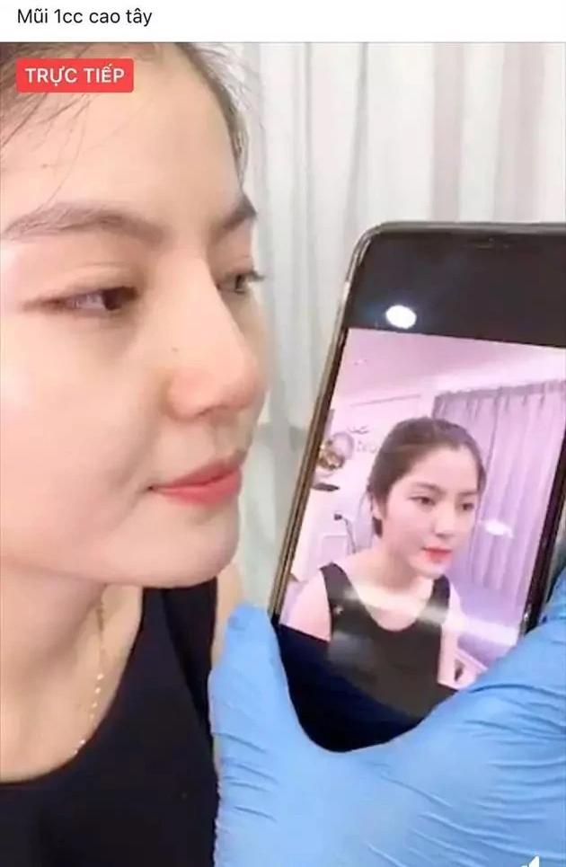 Chu Thanh Huyền ngày càng nhuận sắc, sang chảnh nhờ can thiệp 1 bộ phận trên khuôn mặt-1