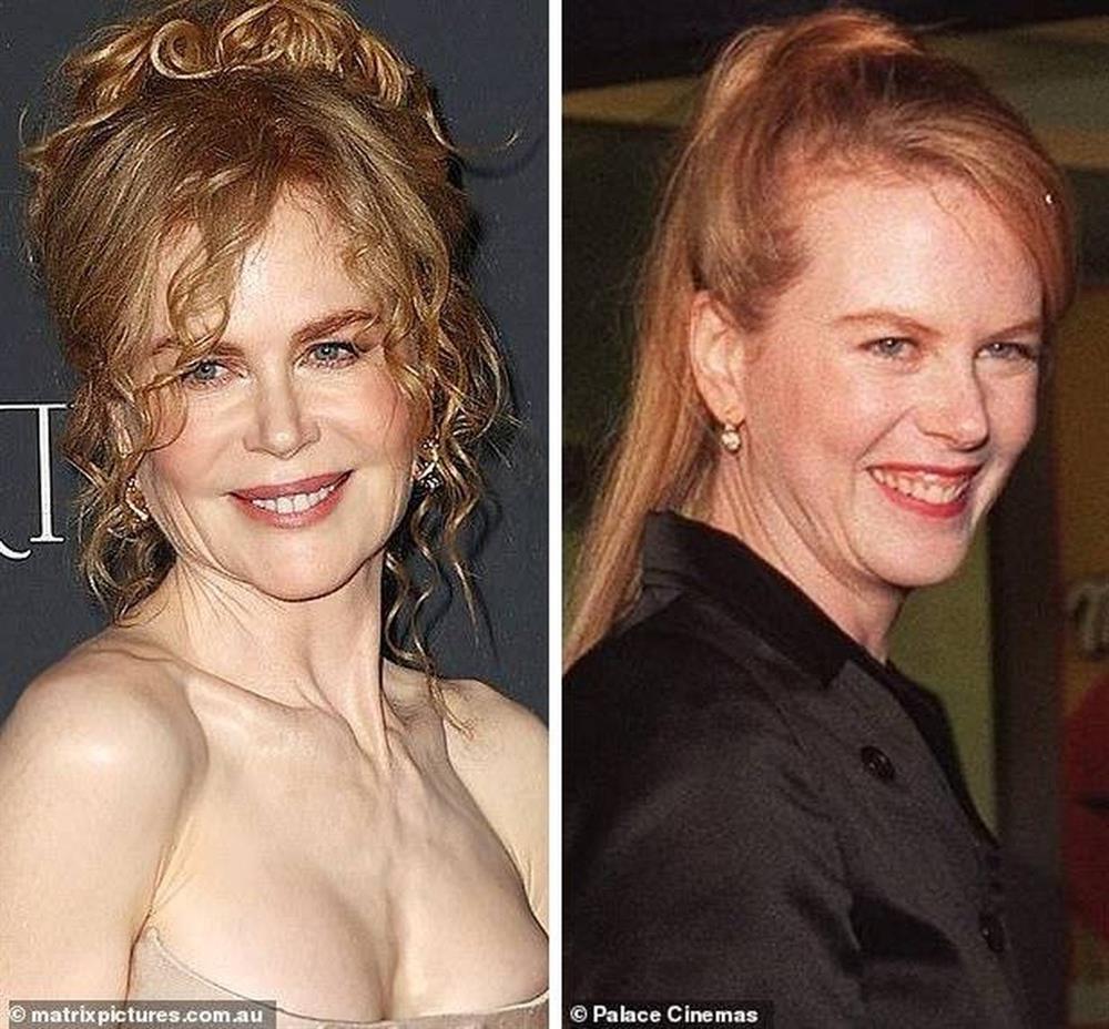 56 tuổi, Nicole Kidman vẫn xứng danh thiên nga Australia-2