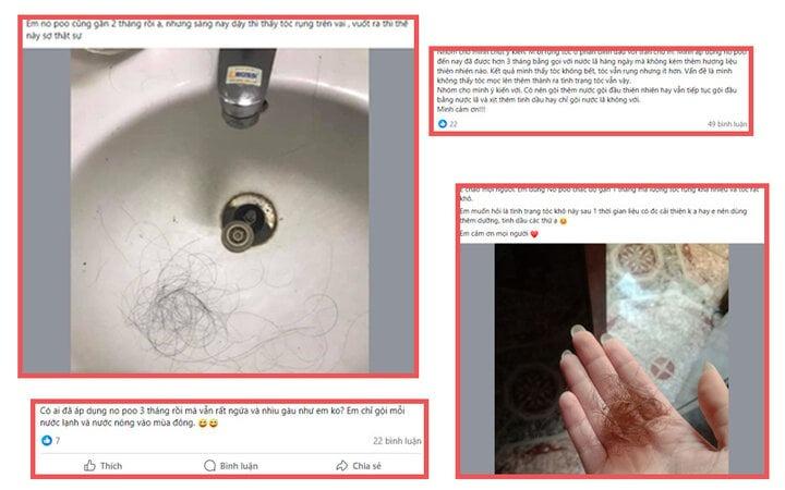 Trào lưu No Poo khiến dân mạng tranh cãi, chuyên gia nói gì?-3