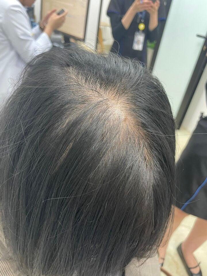 Trào lưu No Poo khiến dân mạng tranh cãi, chuyên gia nói gì?-4