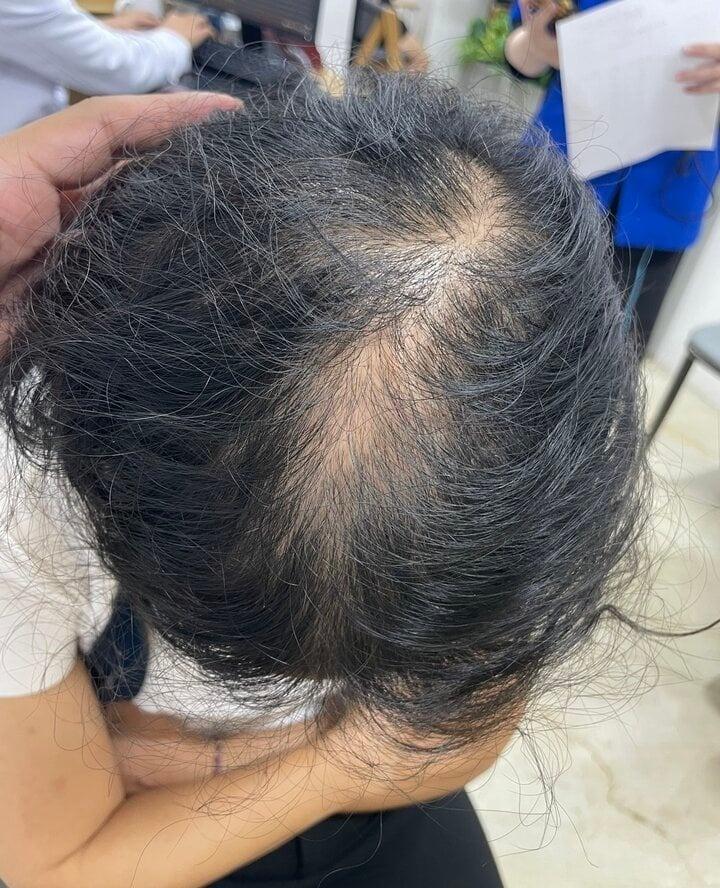 Trào lưu No Poo khiến dân mạng tranh cãi, chuyên gia nói gì?-5