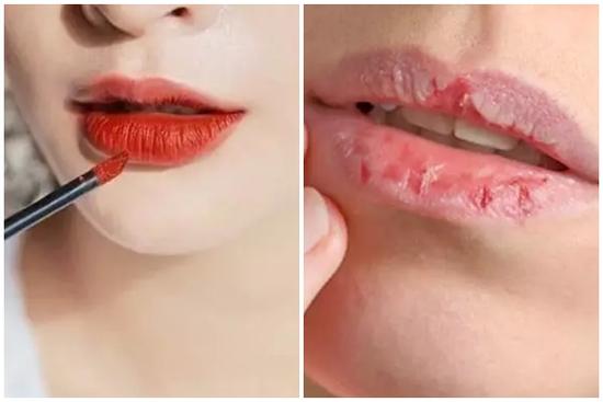 Nhập viện vì thói quen đánh son hàng chục lần mỗi ngày