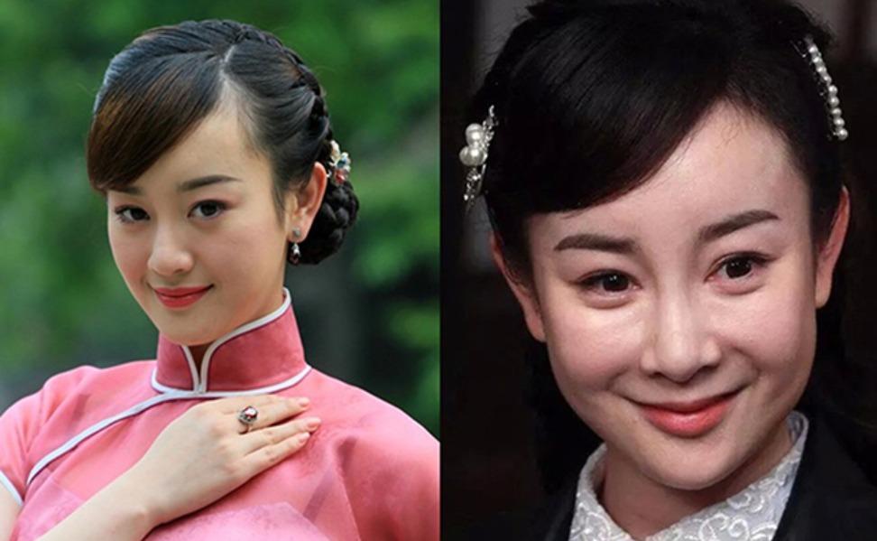 Thần tiên tỷ tỷ Trương Mông tiết lộ bị vô sinh, chấp nhận đau đớn khi châm cứu 600 mũi kim toàn thân để có con-3