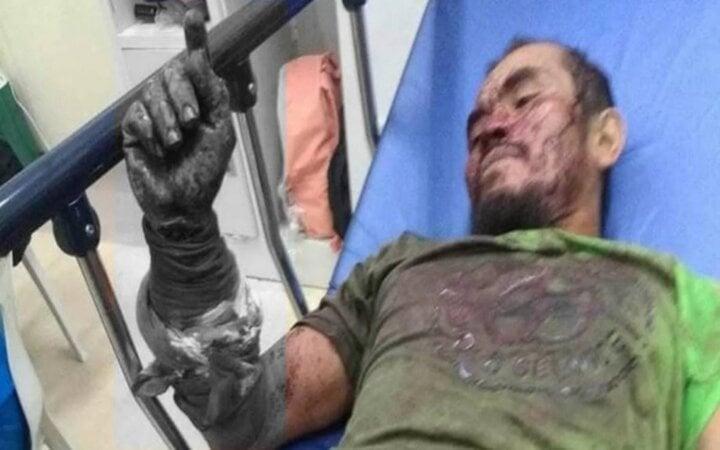 Tấn công nhầm đối thủ, con trăn lớn bị người đàn ông cắn đứt cổ, chết tại chỗ-1