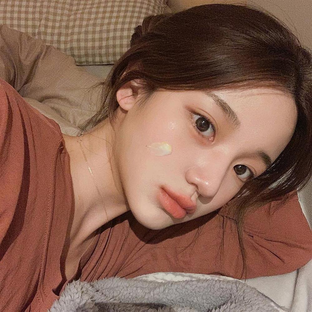 Chị em uống vitamin C chống lão hóa cần nhớ 4 điều để vừa đẹp da, vừa chống sỏi thận-1