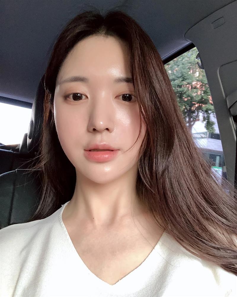 Chị em uống vitamin C chống lão hóa cần nhớ 4 điều để vừa đẹp da, vừa chống sỏi thận-3