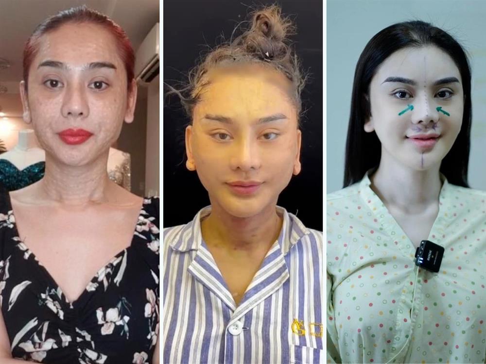 Lâm Khánh Chi: Đổ hàng tỷ đồng để thoả cơn nghiện dao kéo-2