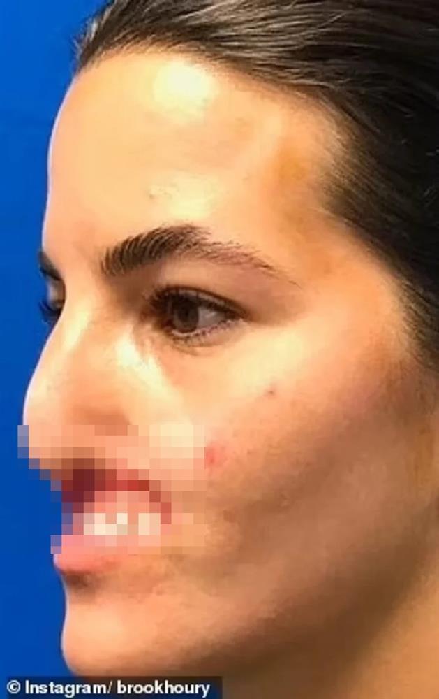 Nữ người mẫu bị chó dữ cắn mất môi trên và hành trình chữa lành gây cảm phục-2
