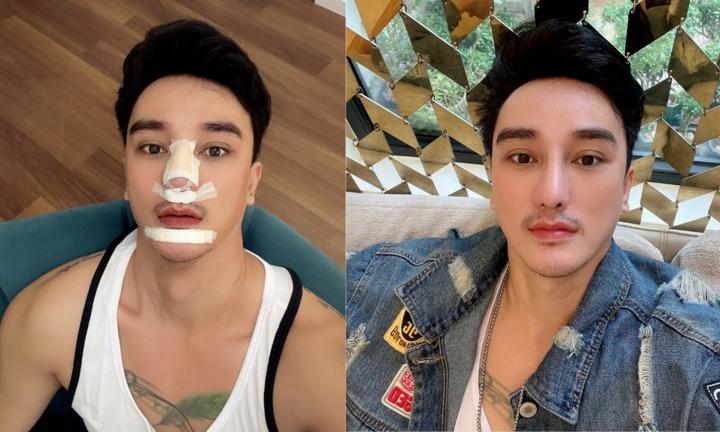 Tâm sự của người đàn ông nghiện phẫu thuật thẩm mỹ-3