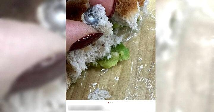 Cô gái tố gãy răng khi ăn bánh mỳ nhân ốc vít, siêu thị bắt xóa bài mới xử lý-1