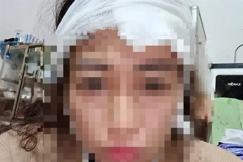 Cô gái kể bố cho mẹ ăn dao cạo, đánh thẳng vùng kín vì dám cắt tóc tém-1