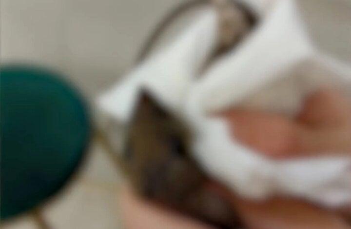 Nữ sinh cắn chảy máu con chuột dám trêu mình khiến bác sĩ kinh hãi-2