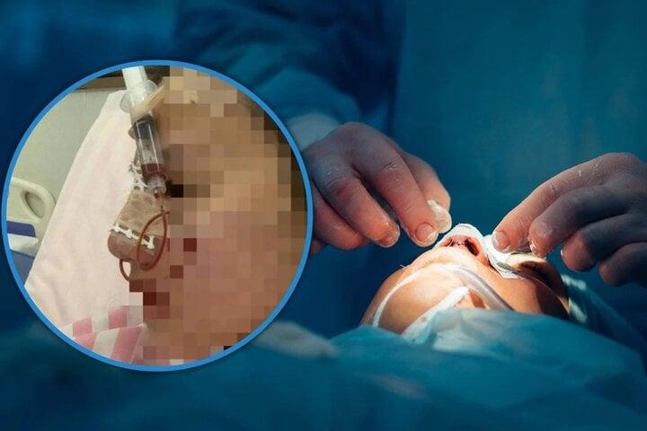 Thẩm mỹ viện tuyển nhân viên để ép sửa mũi với giá cao rồi tìm cớ sa thải-1