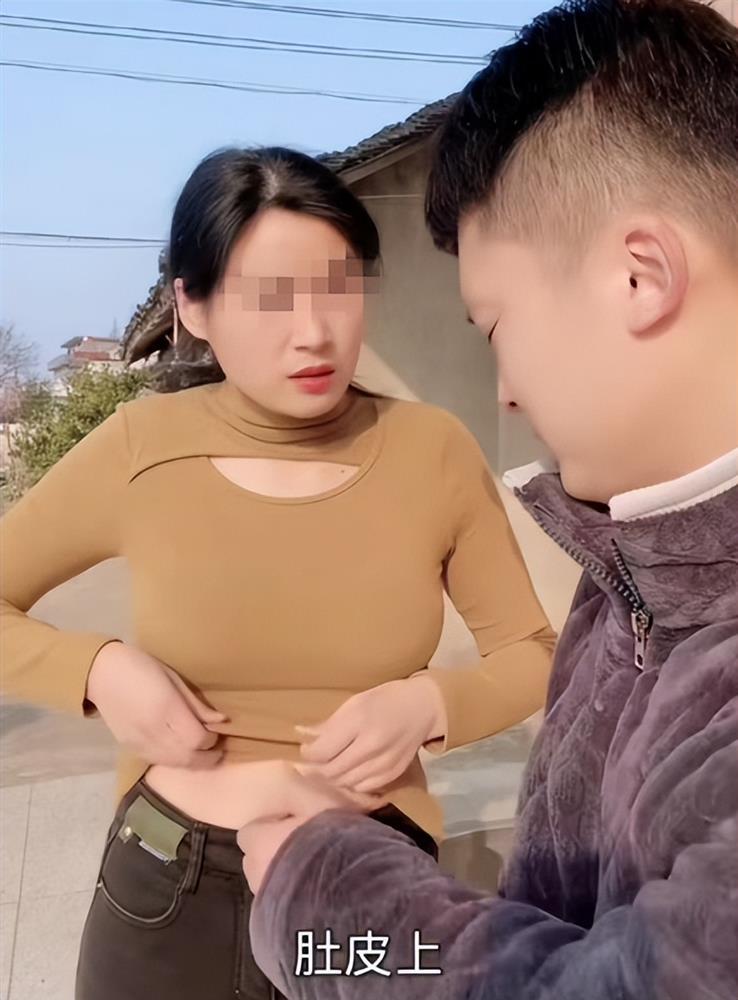 Vợ mới cưới bị rạn da ở bụng, lời giải thích của vợ khiến anh chồng bối rối phải hỏi cộng đồng mạng-1