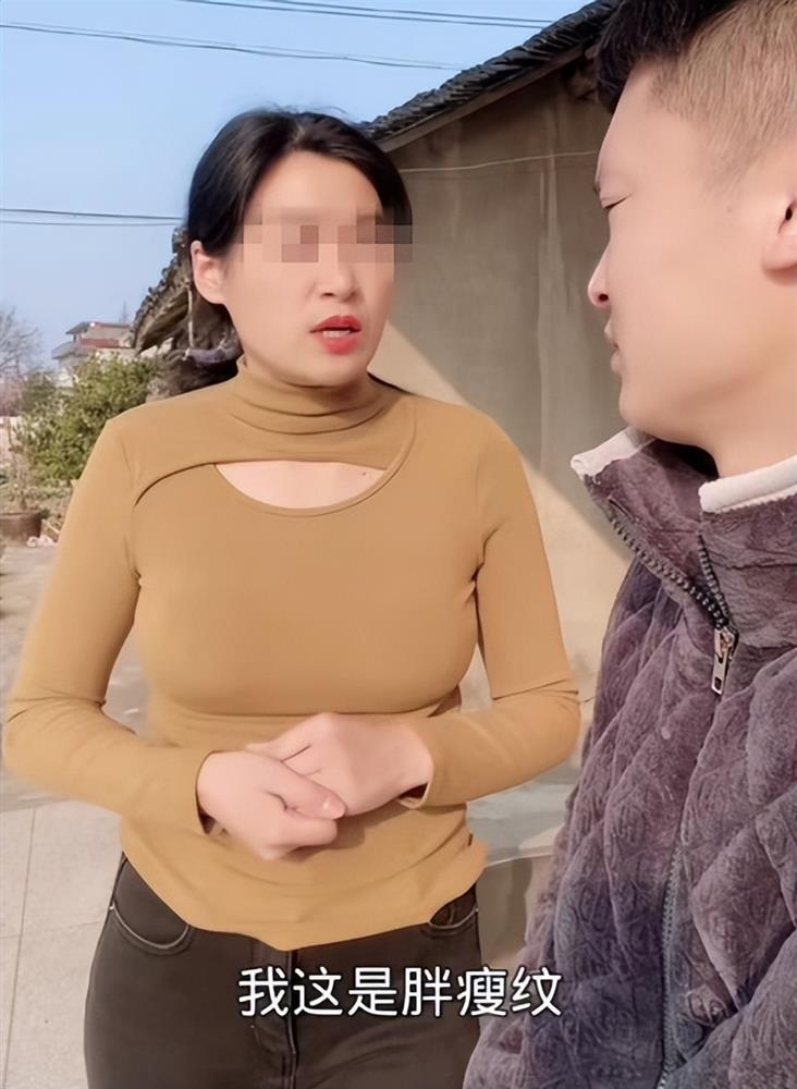 Vợ mới cưới bị rạn da ở bụng, lời giải thích của vợ khiến anh chồng bối rối phải hỏi cộng đồng mạng-2