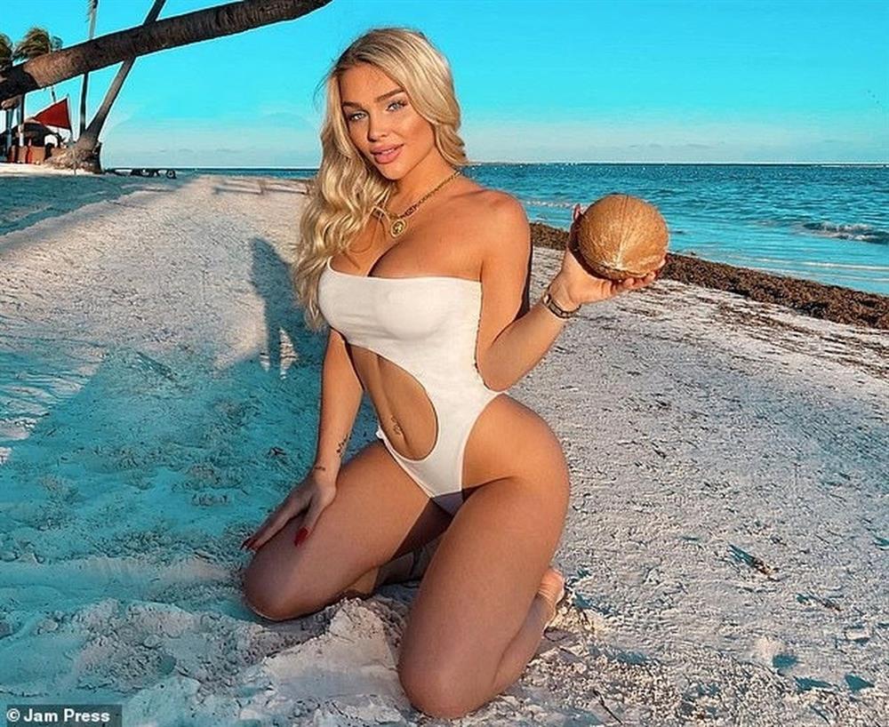 Người mẫu hối hận vì chơi đùa với khỉ, vết cắn nhẹ nhưng hậu quả khó lường-1