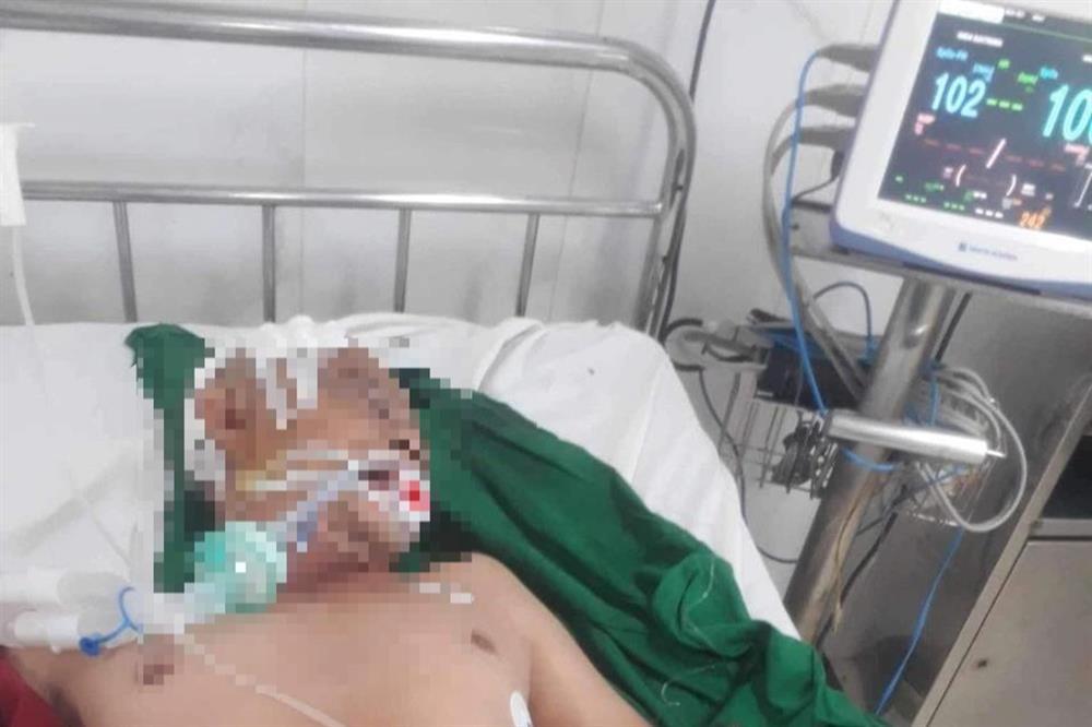 Đang đi đường bị kẻ say rượu đánh vỡ sọ-2