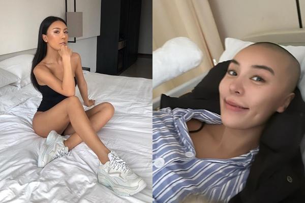 Từ cô gái muốn chữa tật gù lưng đến người mẫu châu Á nổi tiếng thế giới-7