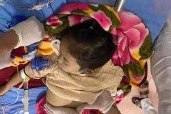 Bé gái 6 tuổi nguy kịch vì bị sặc kẹo