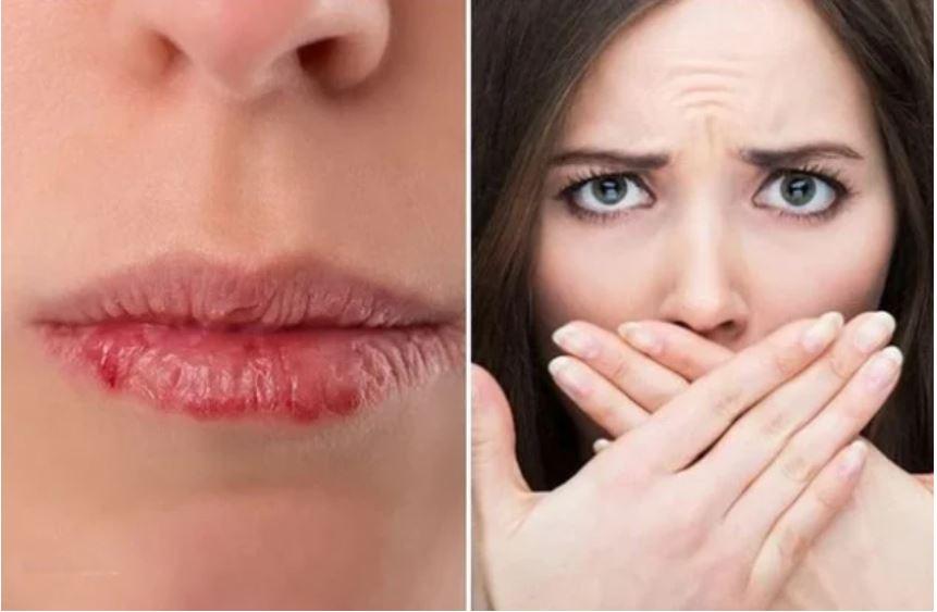 5 sai lầm khiến môi khô, nứt nẻ ngày đông-3