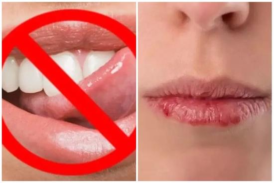 5 sai lầm khiến môi khô, nứt nẻ ngày đông