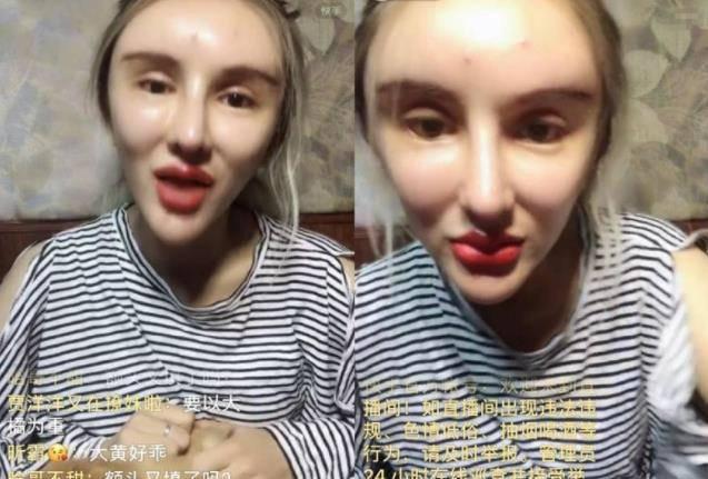 Cô gái chi gần 14 tỷ để trải qua 200 cuộc phẫu thuật thẩm mỹ-5