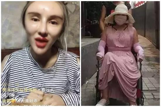 Cô gái chi gần 14 tỷ để trải qua 200 cuộc phẫu thuật thẩm mỹ