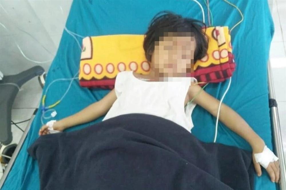 Tự làm thịt cóc ăn, 2 trẻ tử vong, 1 trẻ nguy kịch-1