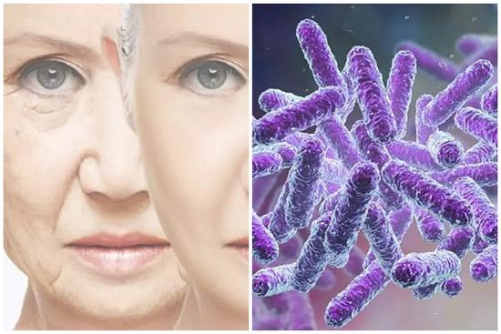 Nghiên cứu mới cho thấy nếp nhăn có thể do hệ vi sinh vật trên da gây ra