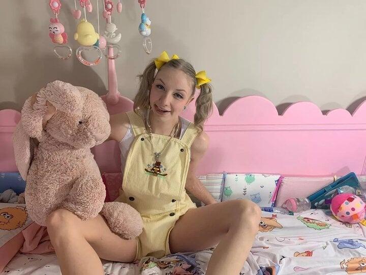 Cô gái sống trong cũi như trẻ sơ sinh, tốn 7 triệu đồng tiền bỉm mỗi tháng-1