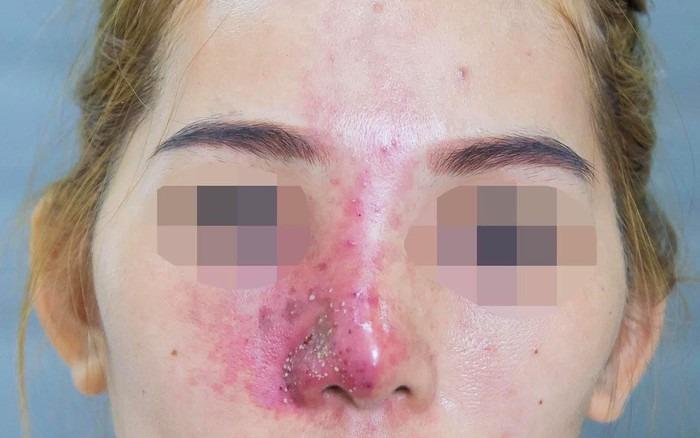 Làm đẹp đón Tết thế nào cho an toàn?-1