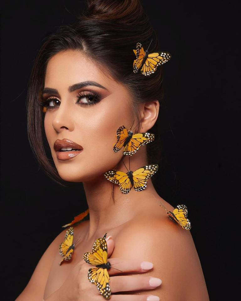 Tân Miss Global body quyến rũ, học vấn khủng và tuổi thơ bị bắt nạt-9