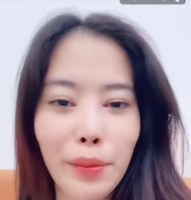 Nam Em lần đầu thừa nhận thẩm mỹ hỏng một điểm trên gương mặt, không dám đụng dao kéo lần nữa-2