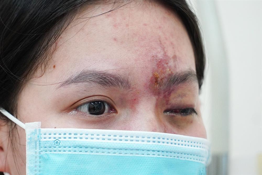 Làm đẹp cuối năm, nhiều người mất Tết vì biến chứng-1