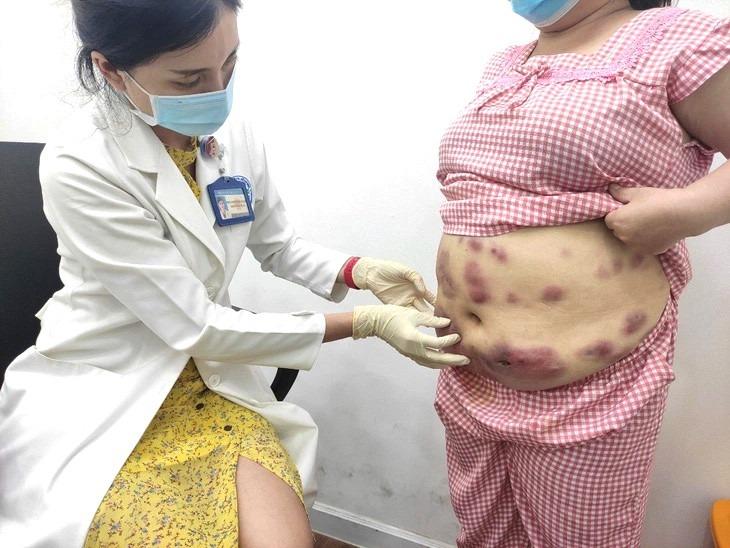 Làm đẹp cuối năm, nhiều người mất Tết vì biến chứng-2