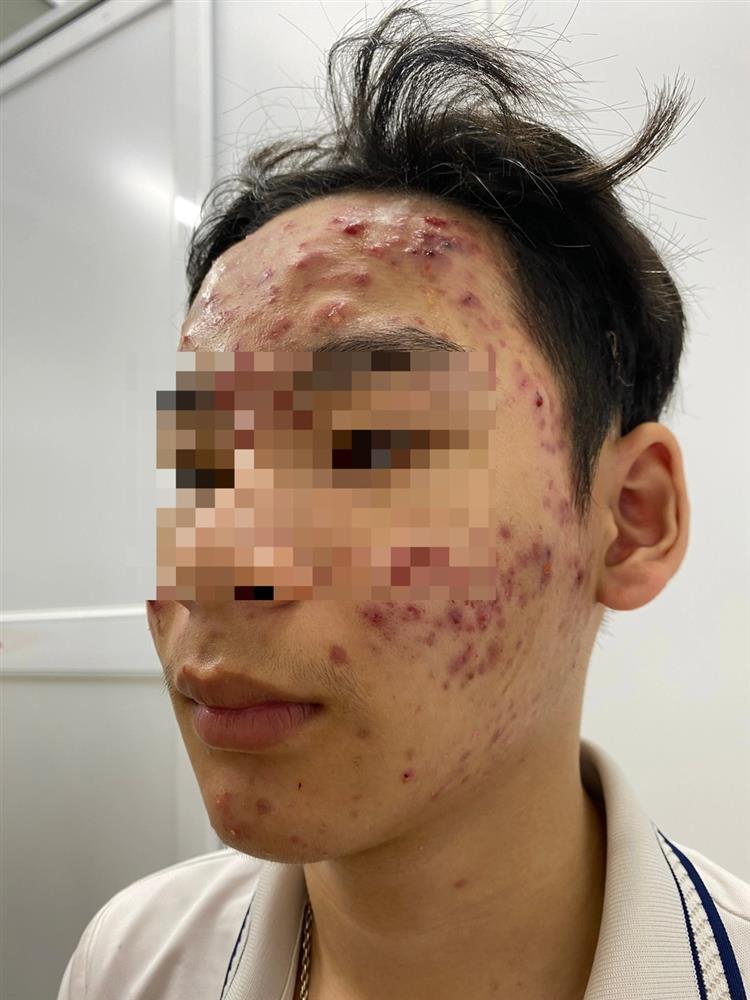 Nhiều người mặt như trận địa vì sập bẫy làm đẹp cấp tốc đón Tết-1