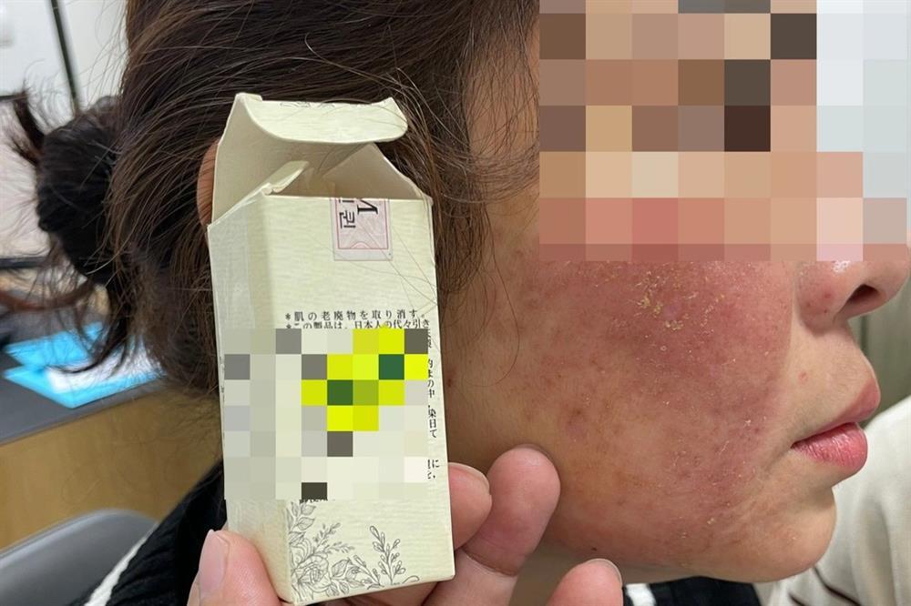 Nhiều người mặt như trận địa vì sập bẫy làm đẹp cấp tốc đón Tết-2