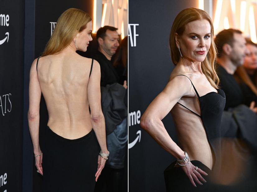 Nicole Kidman bị chê khi mặc váy táo bạo ở tuổi 57-2