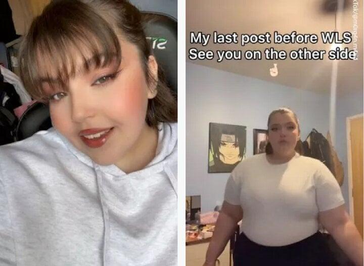 Cắt dạ dày để giảm cân, cô gái trẻ chết thương tâm-1