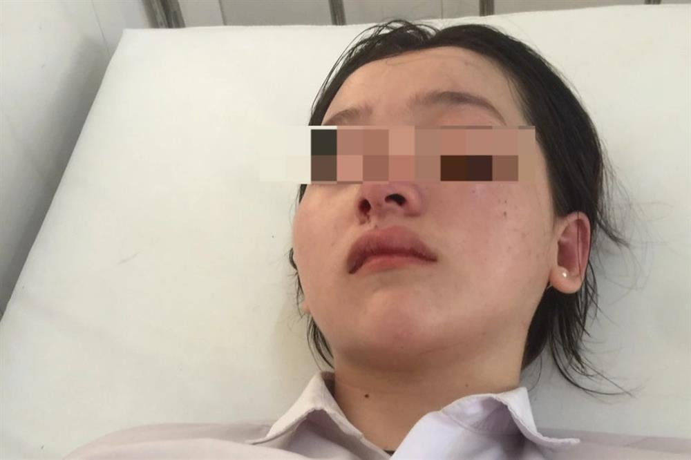 Nữ sinh miền Tây bị 7 người đánh hội đồng gãy xương mũi, chấn thương đầu-2