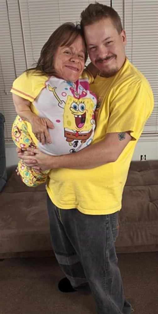 Người phụ nữ cao 70cm lấy soái ca cao 180cm, ba lần mạo hiểm sinh con-2