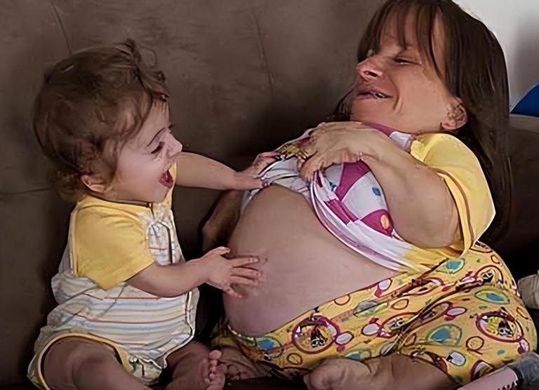 Người phụ nữ cao 70cm lấy soái ca cao 180cm, ba lần mạo hiểm sinh con-3