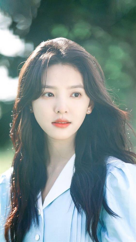 Chương Nhược Nam tiết lộ lý do tóc dày, tưởng phổ biến nhưng không phải ai cũng làm được-2