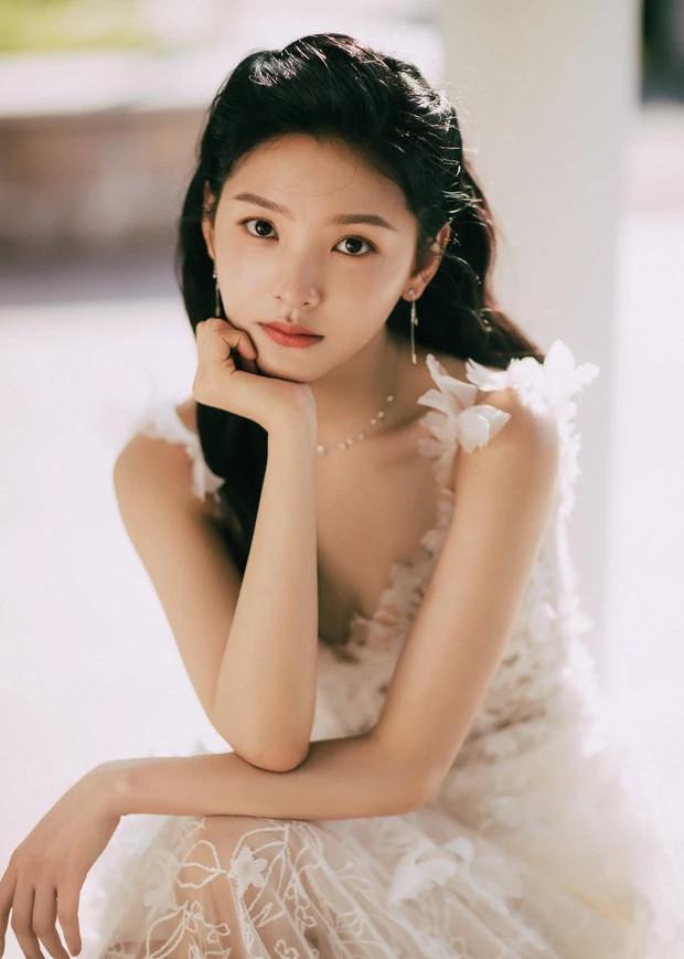 Chương Nhược Nam tiết lộ lý do tóc dày, tưởng phổ biến nhưng không phải ai cũng làm được-3