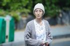 'Nữ hoàng dao kéo xứ Hàn' rụng tóc, teo cơ, hốc hác để giữ cân nặng 37kg