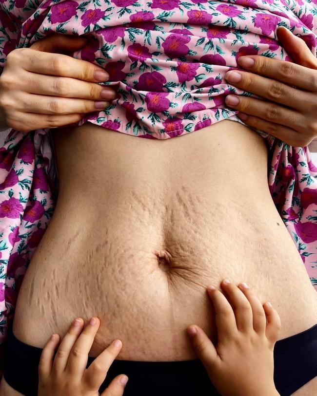 Hòa Minzy: Ai yêu em là yêu luôn mấy vết rạn này đó-3