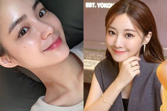 Ngừa thâm nám hiệu quả khi áp dụng đủ 5 bước chăm sóc da