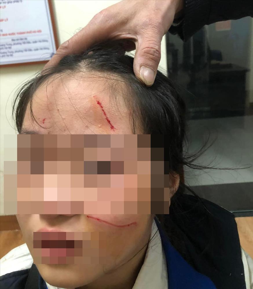 Vụ nữ sinh Hà Nội bị đánh chảy máu mặt: UBND quận yêu cầu làm rõ-1