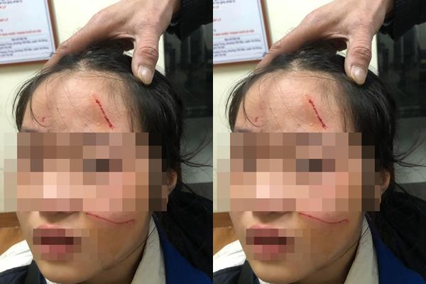 Nữ sinh Hà Nội đánh em lớp dưới chảy máu mặt bị buộc thôi học 6 ngày-2